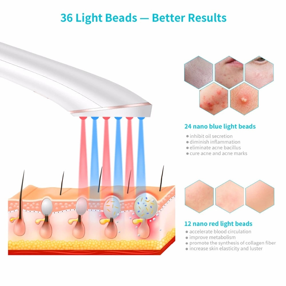 Acne Light Therapy Xpreen Wireless Rechargeable Light Acne Treatment Device Acne Clearing Eraser with Blue Light and Red Light Acne Light Therapy Xpreen Wireless Rechargeable Light Acne Treatment Device Acne Clearing Eraser with Blue Light and Red Light